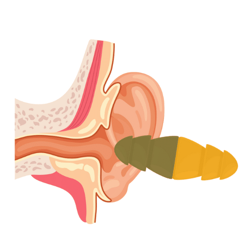 3M Combat Arms Earplugs Lawsuit: What Veterans Should Know